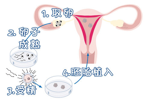 单身生子助孕机构